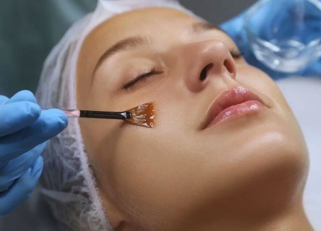 Facial Peel